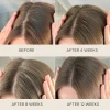 Fortifying Scalp Serum with Amaranth Peptides