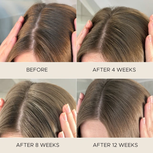 Fortifying Scalp Serum with Amaranth Peptides - 4