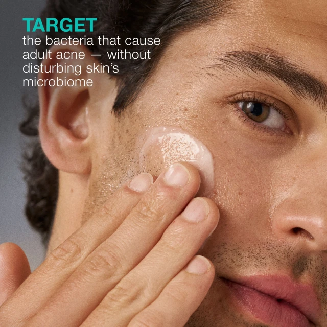 Acne Biotic Moisturizer - 3