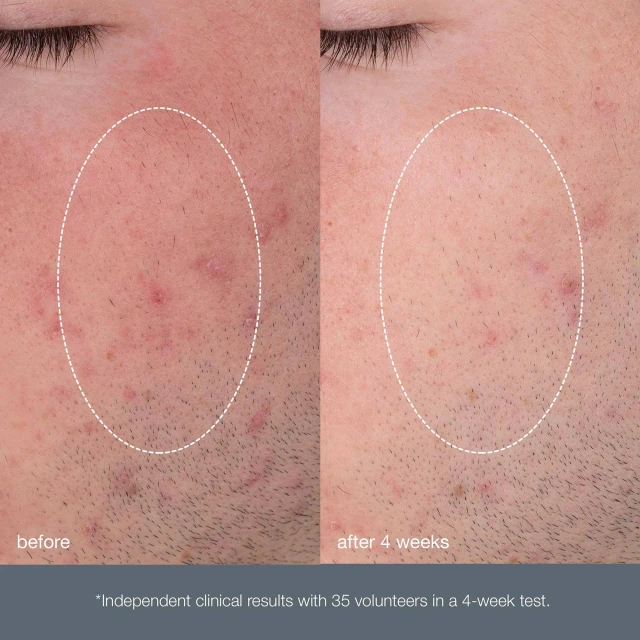 Daily Microfoliant Exfoliator 40 g - 4