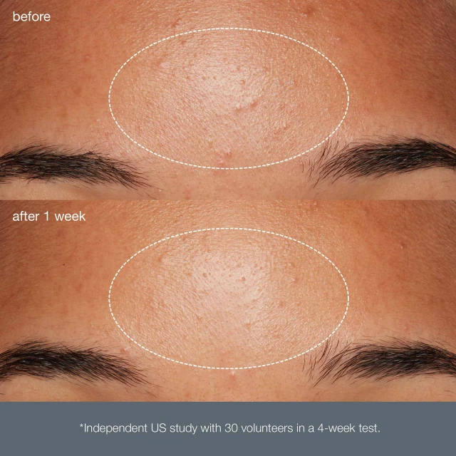 Daily Microfoliant Exfoliator 40 g - 5