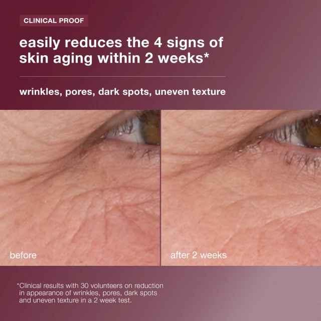 Dynamic Skin Retinol Serum - 3