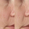 Liquid Peelfoliant