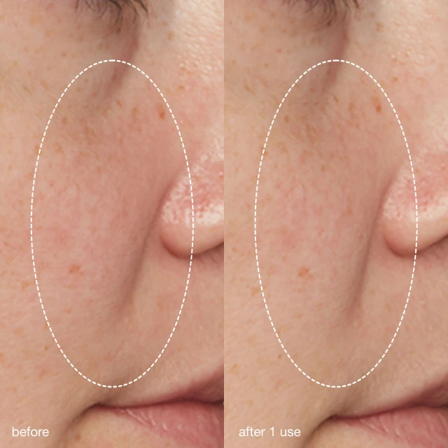 Liquid Peelfoliant - 5