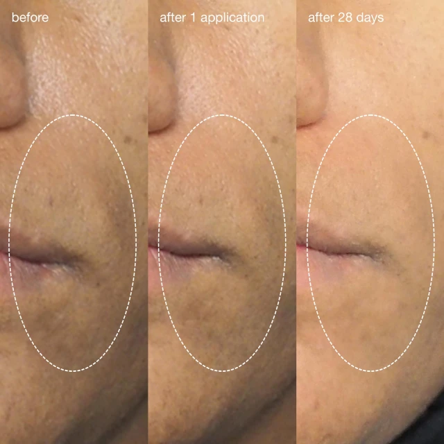 Liquid Peelfoliant - 6