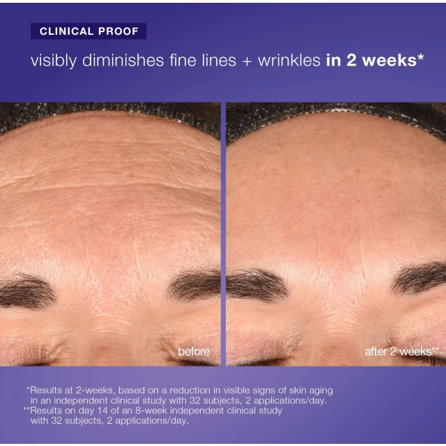 Phyto Nature E² Regenerating Daily Exosome Leave-on Treatment - 4