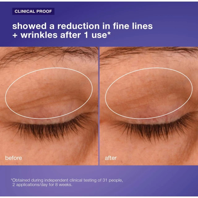 Phyto Nature Lifting Eye Cream - 4