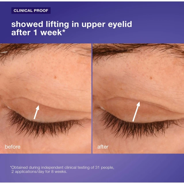 Phyto Nature Lifting Eye Cream - 5