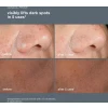 Powerbright Dark Spot Peel