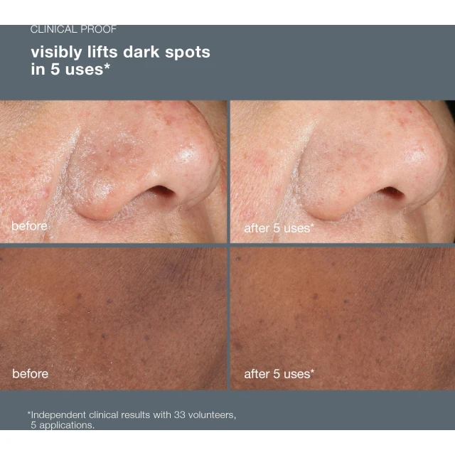 Powerbright Dark Spot Peel - 4
