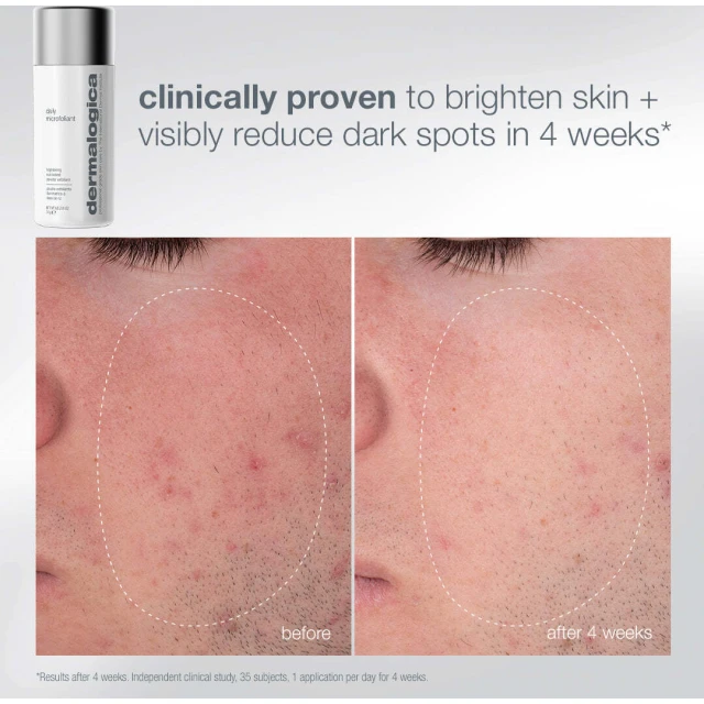 Pro Ritual: Exfoliate + Glow - 3