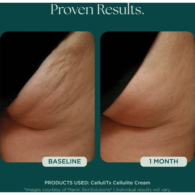 Marini CelluliTx Cellulite Cream - 6