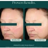 Marini Reboot PDRN Face Serum