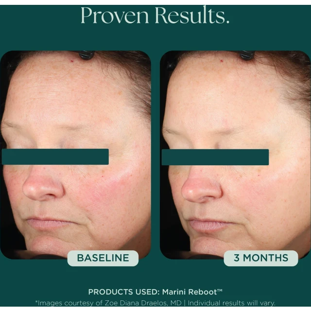 Marini Reboot PDRN Face Serum - 6